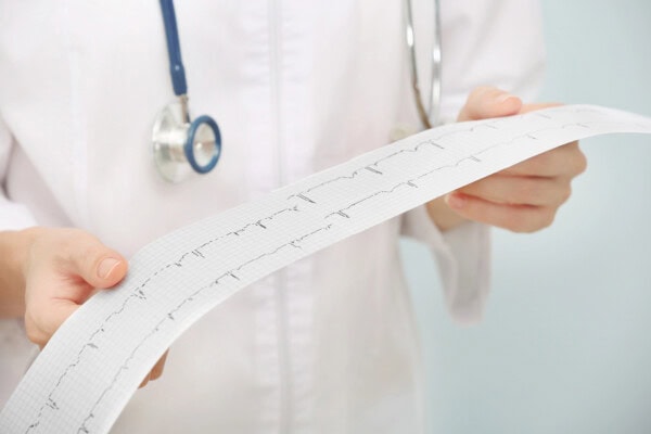 female doctor with stethoscope holding an electrocardiogram on light background