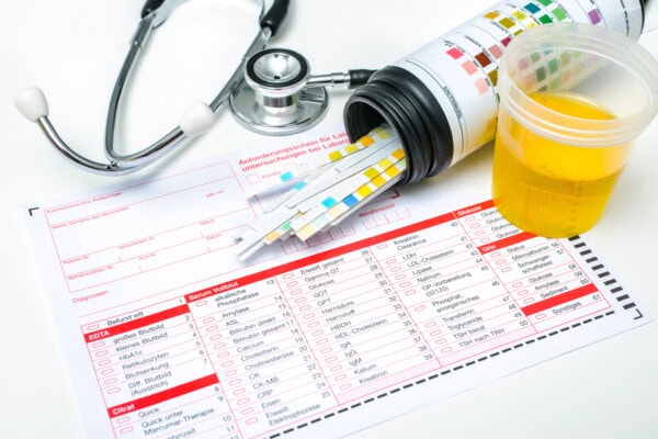 depositphotos 28330799 stock photo urine test strips